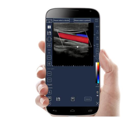 麥迪特國(guó)產(chǎn)手持式超聲多普勒儀C-scan